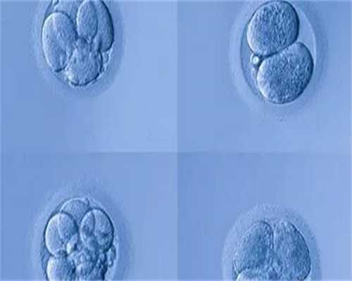 进移植周针灸扎多久有效果？移植前针灸几次效果好？